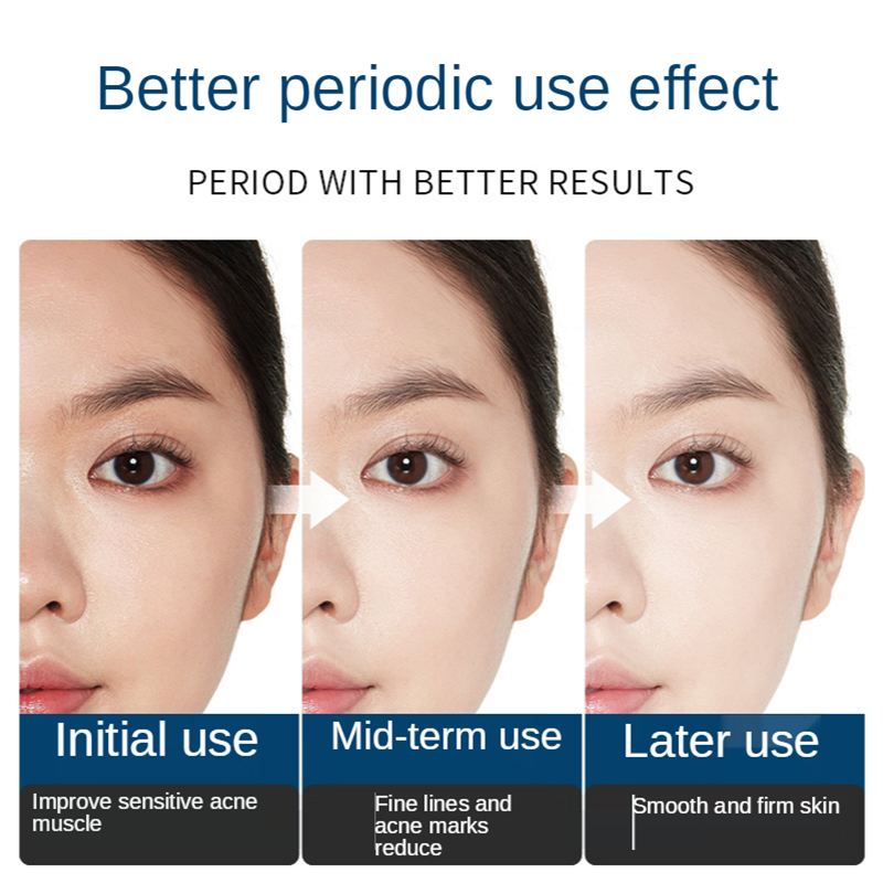 Facial Repair Lyophilized Powd - Oligopeptide Wrinkle review and price